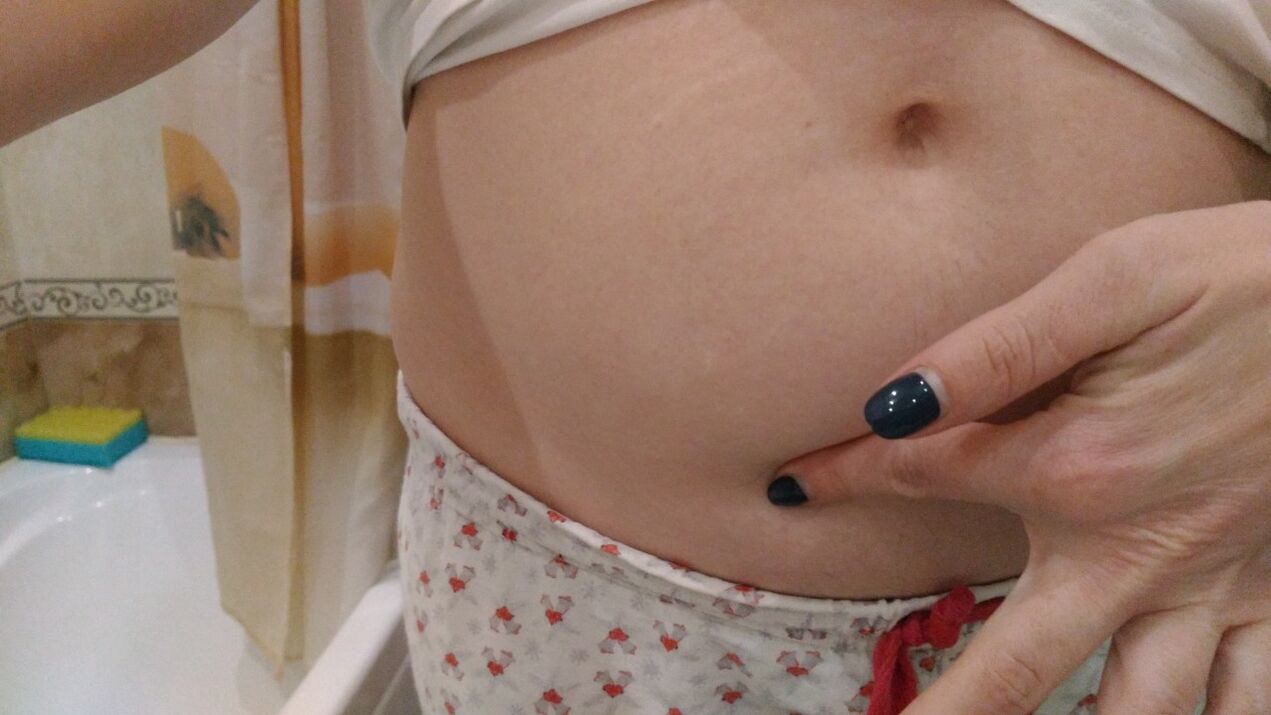 Helmintoen infekzioaren seinaleak esperientzia pertsonaletik