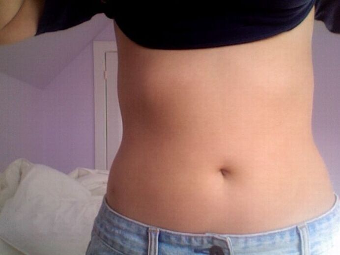 NEOflorax kapsulekin tratamenduaren emaitza