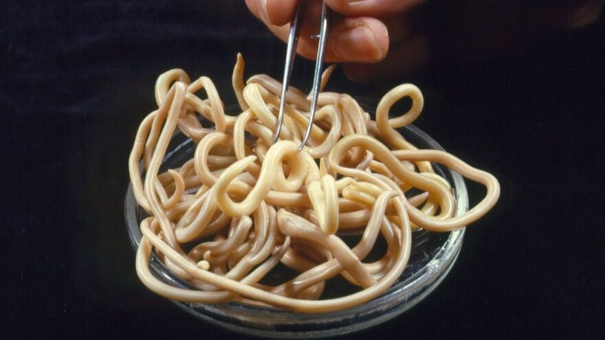 giza gorputzetik parasitoak