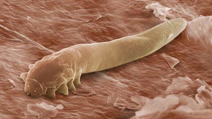 Larruazalpeko parasitoa mikroskopioan